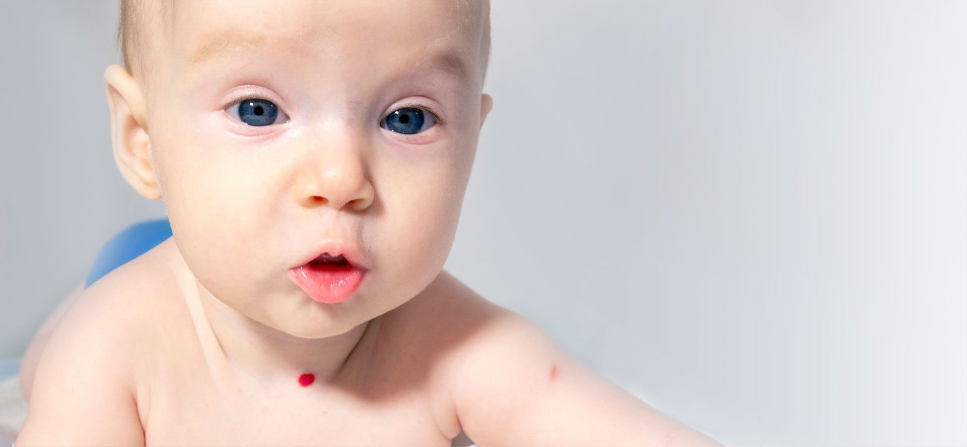 Pediatric Comprehensive Total Body Skin Examination Babies Infants