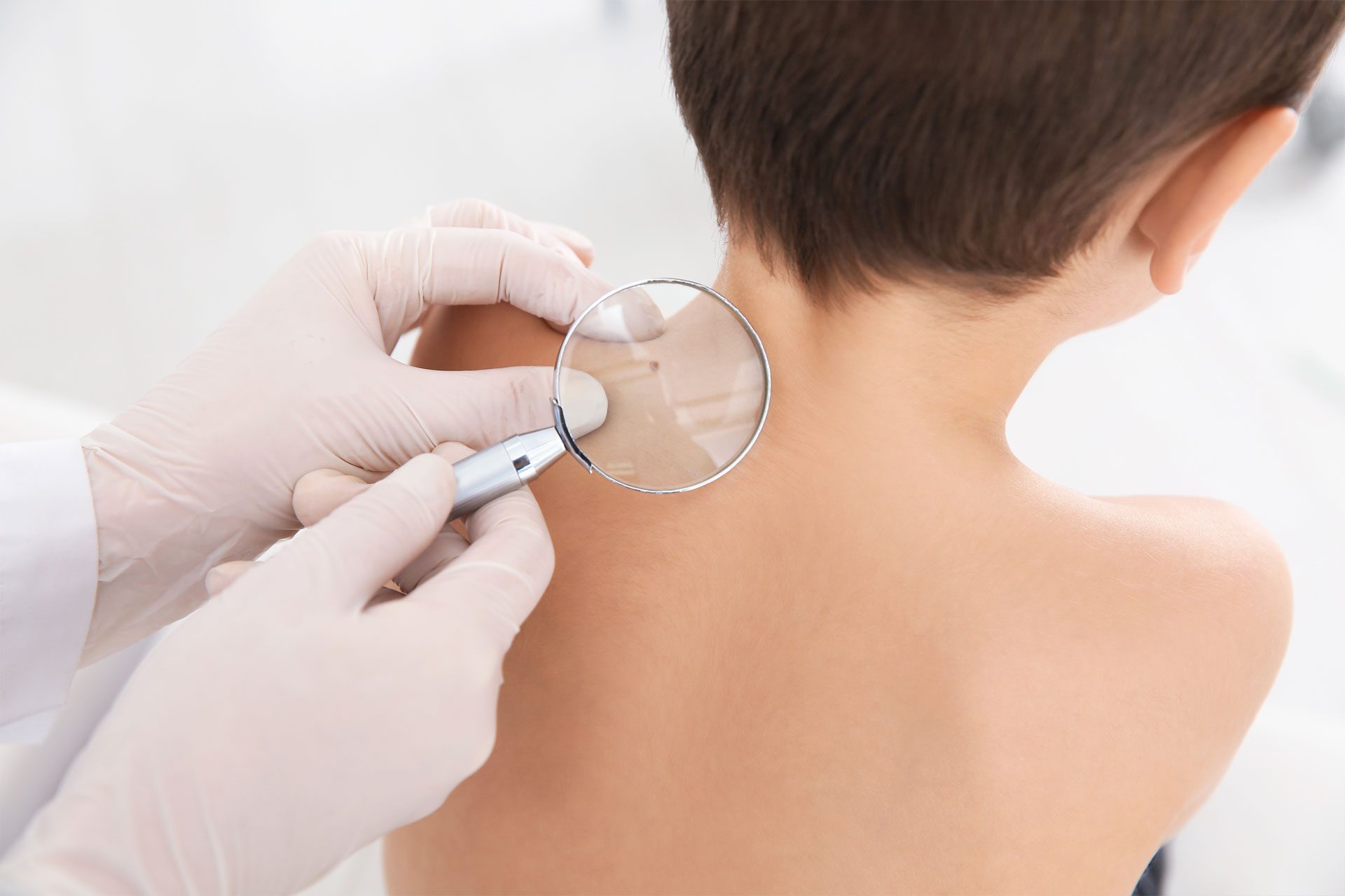 Pediatric Comprehensive Total Body Skin Examination Moles Birthmarks